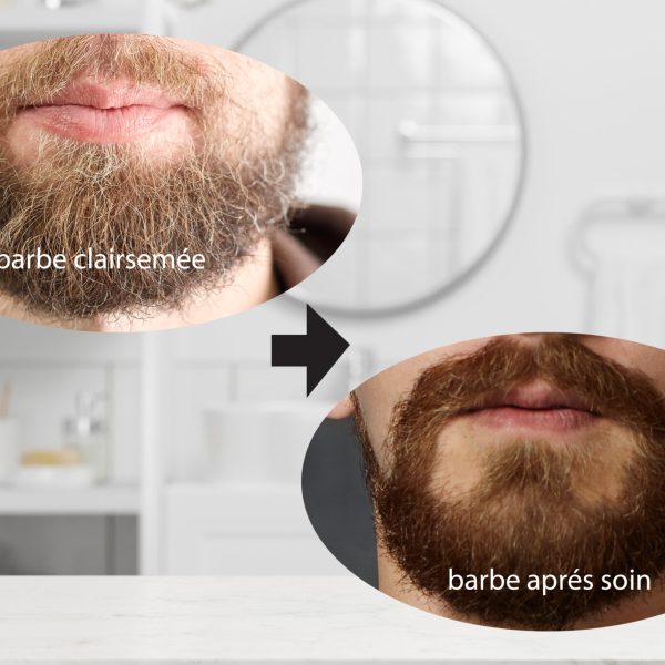 Conseils pour prendre soin dune barbe clairsemee detail 01 2048x1365 1